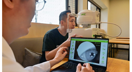 Acer Medical’s AI Tools Transform Eye and Bone Disease Screening Across Asia